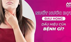 Đau Họng Nuốt Nước Bọt Khó